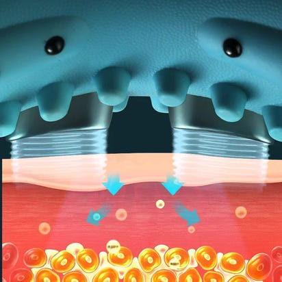 Cervical Relief Massager NECKEASE™